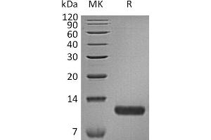 Chemokine (C-C Motif) Ligand 17 (CCL17) protein (His tag)