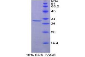 SDS-PAGE analysis of Mouse Protein Kinase C zeta Protein.