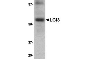 Western Blotting (WB) image for anti-Leucine-Rich Repeat LGI Family, Member 3 (LGI3) (Middle Region) antibody (ABIN1030983) (LGI3 antibody  (Middle Region))