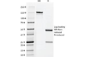 SDS-PAGE Analysis Purified hCG Mouse Monoclonal Antibody (HCGab/52). (CGA (HCG-Alpha) & CGB (HCG-Beta) antibody)
