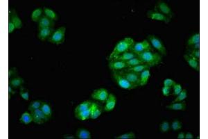 Immunofluorescent analysis of HepG2 cells using ABIN7152590 at dilution of 1:100 and Alexa Fluor 488-congugated AffiniPure Goat Anti-Rabbit IgG(H+L) (Fascin antibody  (AA 2-187))