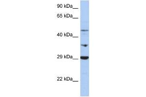 PDK3 antibody used at 1 ug/ml to detect target protein. (PDK3 antibody  (Middle Region))
