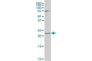 RGS19 polyclonal antibody (A02), Lot # 050926JC01. (RGS19 antibody  (AA 51-140))