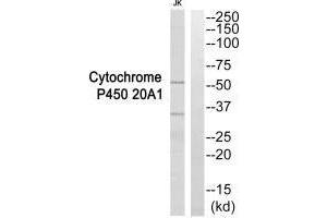 Western blot analysis of extracts from Jurkat cells, using Cytochrome P450 20A1 antibody. (Cytochrome P450, Family 2, Subfamily A, Polypeptide 1 (CYP2A1) antibody)