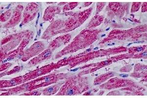 Human, Heart: Formalin-Fixed Paraffin-Embedded (FFPE) (CKMT2 antibody  (AA 231-280))