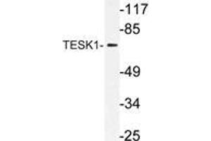 Western blot (WB) analysis of TESK1 antibody in extracts from rat liver cells. (TESK1 antibody)