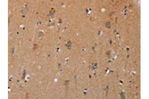 The image on the left is immunohistochemistry of paraffin-embedded Human brain tissue using ABIN7191717(NRG3 Antibody) at dilution 1/30, on the right is treated with synthetic peptide. (Neuregulin 3 antibody)