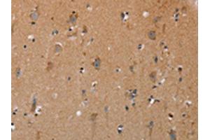 The image on the left is immunohistochemistry of paraffin-embedded Human brain tissue using ABIN7191717(NRG3 Antibody) at dilution 1/30, on the right is treated with synthetic peptide. (Neuregulin 3 antibody)