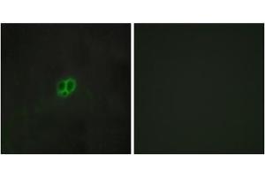 Immunofluorescence analysis of MCF-7 cells, using CRHR1 antibody.
