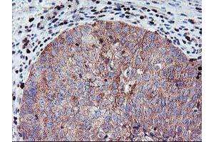Image no. 2 for anti-Myocyte Enhancer Factor 2C (MEF2C) antibody (ABIN1499363) (MEF2C antibody)