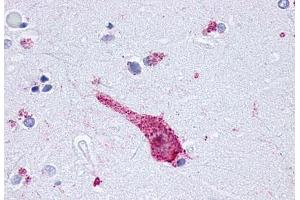 Anti-OPRM1 / Mu Opioid Receptor antibody  ABIN1049171 IHC staining of human brain, neuron. (Mu Opioid Receptor 1 antibody  (C-Term))