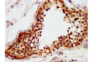 IHC image of ABIN7151284 diluted at 1:600 and staining in paraffin-embedded human testis tissue performed on a Leica BondTM system. (TRIM71 antibody  (AA 125-209))