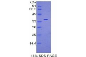 SDS-PAGE (SDS) image for Coagulation Factor V (F5) (AA 1863-2161) protein (His tag) (ABIN2120835) (Coagulation Factor V Protein (F5) (AA 1863-2161) (His tag))