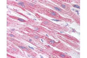 Anti-CRIP2 antibody IHC of human heart. (CRIP2 antibody  (AA 78-127))