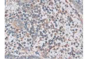 Immunohistochemistry (IHC) image for anti-V-Akt Murine Thymoma Viral Oncogene Homolog 3 (Protein Kinase B, Gamma) (AKT3) (AA 46-338) antibody (ABIN7431704)