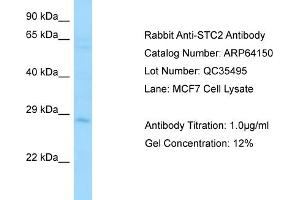Western Blotting (WB) image for anti-Stanniocalcin 2 (STC2) (C-Term) antibody (ABIN2789749) (Stanniocalcin 2 antibody  (C-Term))
