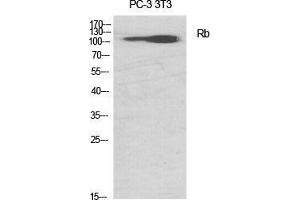 Western Blot (WB) analysis of specific cells using Rb Polyclonal Antibody. (Retinoblastoma 1 antibody  (Thr676))