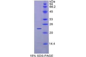 SDS-PAGE analysis of Mouse GaA Protein. (GAA Protein)