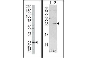Image no. 1 for anti-Adenylate Kinase 4 (AK4) (C-Term) antibody (ABIN360619) (AK4 antibody  (C-Term))