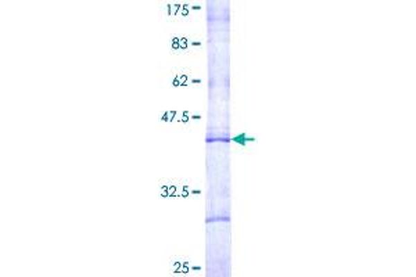 CPT1B Protein (AA 673-772) (GST tag)