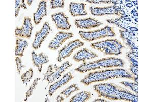 IHC analysis of HDAC5 using anti-HDAC5 antibody (ABIN7599922). (HDAC5 antibody  (AA 13-1107))