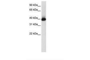 Image no. 1 for anti-GS Homeobox 2 (GSX2) (AA 214-263) antibody (ABIN203048) (GSX2 antibody  (AA 214-263))
