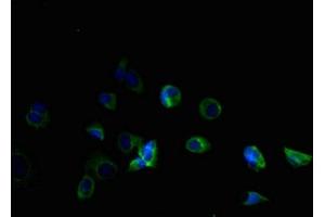 Immunofluorescent analysis of MCF-7 cells using ABIN7173107 at dilution of 1:100 and Alexa Fluor 488-congugated AffiniPure Goat Anti-Rabbit IgG(H+L) (TMEM184B antibody  (AA 311-407))