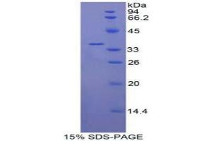 SDS-PAGE analysis of Human IL22R Protein. (IL22R Protein)
