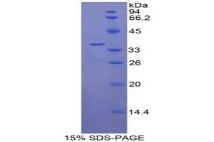 Interleukin 22 Receptor (IL22R) protein
