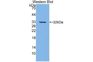 Detection of Recombinant ENTPD1, Human using Polyclonal Antibody to Ectonucleoside Triphosphate Diphosphohydrolase 1 (ENTPD1) (CD39 antibody  (AA 241-486))