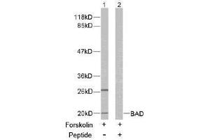 Image no. 2 for anti-BCL2-Associated Agonist of Cell Death (BAD) (Ser136) antibody (ABIN197210)
