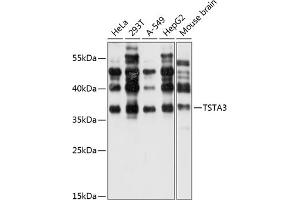 Western blot analysis of extracts of various cell lines, using TST antibody (ABIN6127523, ABIN6149663, ABIN6149664 and ABIN6220526) at 1:1000 dilution.