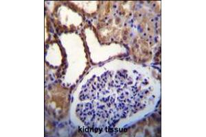 WNK3(PRKWNK3) Antibody immunohistochemistry analysis in formalin fixed and paraffin embedded human kidney tissue followed by peroxidase conjugation of the secondary antibody and DAB staining. (WNK3 antibody  (C-Term))