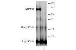JMJD2B / KDM4B antibody (rAb) tested antibody tested by immunoprecipitation.