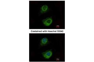 ICC/IF Image Immunofluorescence analysis of methanol-fixed HeLa, using HSP70 1B, antibody at 1:500 dilution. (HSPA1B antibody  (Center))