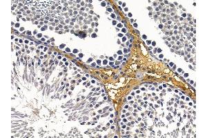 ABIN6260161 and ABIN6279063 at 1/100 staining rat testis tissue by IHC-P. (AWAT2 antibody  (Internal Region))