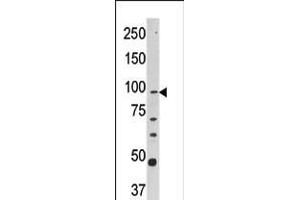 Western blot analysis of anti-CPT1A Pab in Y79 cell line lysate (35ug/lane). (CPT1A antibody  (C-Term))