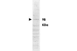 Western blot using POLK polyclonal antibody  shows detection ofa band ~98 KDa corresponding to human POLK (arrowhead). (POLK antibody  (AA 817-830))