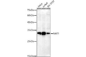 NAT1 anticorps