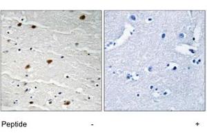 Immunohistochemistry analysis of paraffin-embedded human brain tissue using AKT1 polyclonal antibody . (AKT1 antibody)