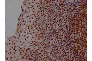 Immunohistochemistry (IHC) image for anti-High Mobility Group Box 1 (HMGB1) antibody (ABIN7127545)