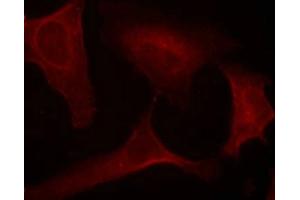 Immunofluorescence staining of methanol-fixed Hela cells using MEK1(Phospho-Ser221) Antibody. (MEK1 antibody  (pSer221))