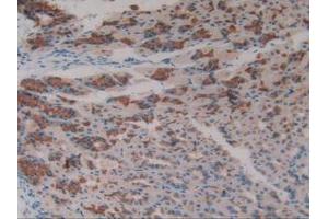IHC-P analysis of Mouse Stomach Tissue, with DAB staining. (Asialoglycoprotein Receptor 1 antibody  (AA 80-281))
