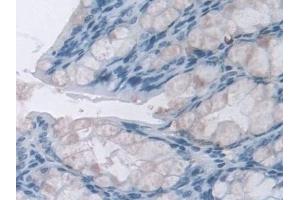 Immunohistochemistry (IHC) image for anti-NAD(P)H Dehydrogenase, Quinone 1 (NQO1) (AA 2-274) antibody (ABIN7430129)