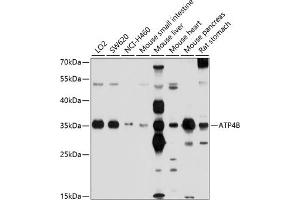 Western blot analysis of extracts of various cell lines, using B antibody (ABIN6130981, ABIN6137322, ABIN6137323 and ABIN6214233) at 1:1000 dilution. (ATP4b antibody  (AA 62-291))
