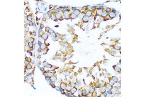 Immunohistochemistry of paraffin-embedded rat testis using STIP1 Rabbit mAb (ABIN1512566, ABIN3020619, ABIN3020620 and ABIN7101303) at dilution of 1:100 (40x lens). (STIP1 antibody)