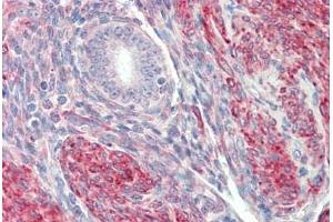 Human Uterus: Formalin-Fixed, Paraffin-Embedded (FFPE) (Leiomodin 1 antibody  (N-Term))