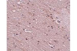 Immunohistochemistry (IHC) image for anti-Anoctamin 2 (ANO2) (N-Term) antibody (ABIN1031629) (Anoctamin 2 antibody  (N-Term))