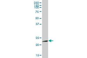 AK1 MaxPab polyclonal antibody. (Adenylate Kinase 1 antibody  (AA 1-194))