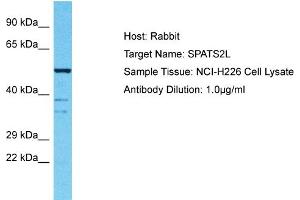 Host: Rabbit Target Name: SPATS2L Sample Tissue: Human NCI-H226 Whole Cell Antibody Dilution: 1ug/ml (SPATS2L antibody  (N-Term))